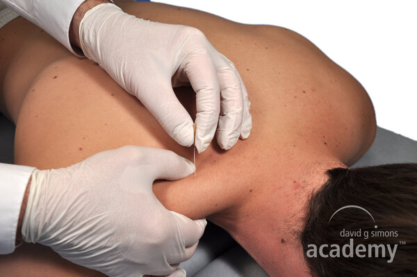 Trapezius pars descendens IMS