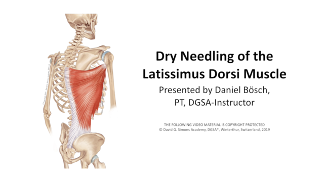 {{ video.title }}